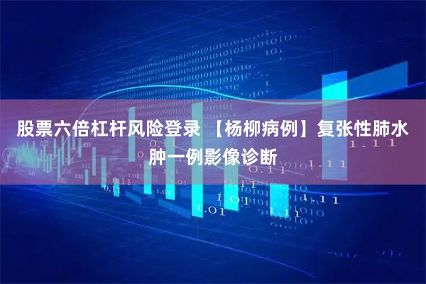 股票六倍杠杆风险登录 【杨柳病例】复张性肺水肿一例影像诊断
